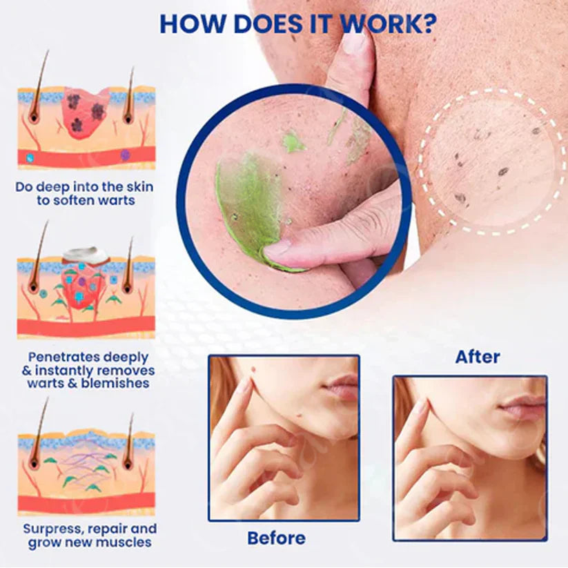 Pimple & Scar Solution: 2% Salicylic Exfoliant + High-Potency VC Essence