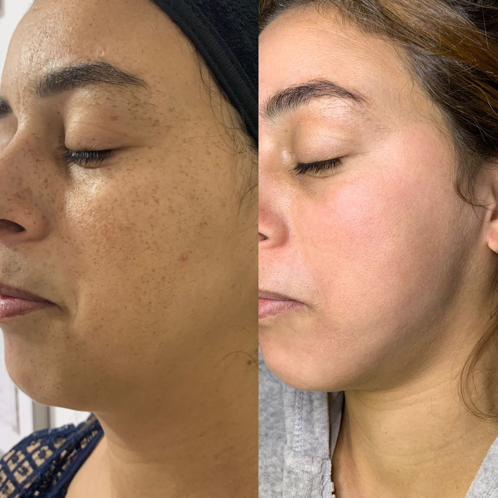 Éternelle Lumière Collagen Spot-Correction & Youth Renewal Collection